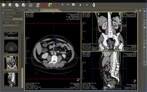 dicom image viewer for mac.